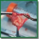 Application of Recellularized Non-Woven Materials from Collagen-Enriched Polylactide for Creation of Tissue-Engineered Diaphragm Constructs