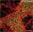 Morphofunctional Patterns of Neuronal Network Developing in Dissociated Hippocampal Cell Cultures