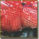 Strength Properties of Abdominal Wall in Intraperitoneal and Retromuscular Repair Using Lightweight and Ultra-Lightweight Synthetic and Titanium-Containing Endoprostheses (Experimental Study)
