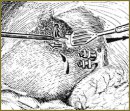 The Effectiveness of Tachocomb Use in Hepatobiliary Surgery