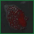 Biodistribution of the Bombesin Receptor-Targeted Radiopharmaceutical Precursor BBN/C1-C2 in a Prostate Cancer Model