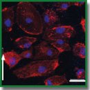 Effectiveness of Using Endothelial Colony-Forming Cells for Creating Tissue-Engineered Vascular Grafts under <i>in vitro</i> Conditions