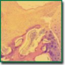 Replacement of Osteochondral Defects of Major Joints in Experiment