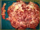 The Analysis of Postoperative Complications after Thrombectomy From Inferior Vena Cava in Renal Cell Carcinoma
