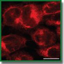 Model of Ovarian Adenocarcinoma Spheroids for Assessing Photodynamic Cytotoxicity