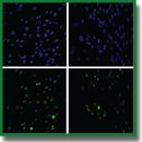 Измеримые метрики клеточного старения мезенхимальных стволовых клеток
