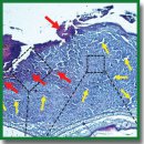 Optical Coherence Elastography for Non-Invasive Monitoring of Tumor Elasticity under Chemotherapy: Pilot Study