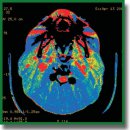 Surgical Treatment of Intramedullary Hemangioblastomas: Current State of Problem (Review)