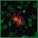 Immunohistochemical Detection of Microglia Using Iba-1 as a Marker in Health and Disease