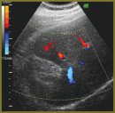 Normal Echosemiotics of Resected Parenchymatous Organs