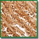 Pathomorphological Assessment Method of Myocardial Infarction Age