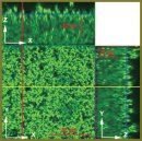 Modern Technologies of Bacterial Biofilm Study