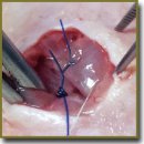 Prosthetic Repair of the Abdominal Wall Using Light and Ultra-Light Synthetic and Titan-Containing Materials in High Bacterial Contamination (Experimental Study)
