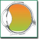 Silicone Oil Tamponade Hydrostatics and Technology for Additional Mechanical Support of Retina