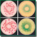 Application of Dimethicone to Prevent Culture Media from Drying in Microbiological Diagnostics