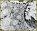 Lipid Metabolism and Ultrastructure of Hepatocytes  in Postreperfusive Period at the Ozonized Physiologic Solution Use  in Experiment