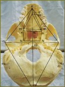 Anthropometric Study of HIP-plane Morphology and Correlation Relations of Its Parameters with Cerebral and Facial Cranium Measurements