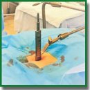 Open and Minimally Invasive Technologies in Surgical Treatment of Stable Symptomatic Stenosis of the Lumbar Spine