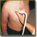 Ultrasound Monitoring and Age Sonographic Characteristics of Community-Acquired Pneumonia in Children	