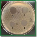 Evaluation of the Feasibility of Using Commercial Wound Coatings as a Carrier Matrix for Bacteriophages