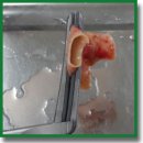 Histological Justification for the Need of Radiofrequency Ablation of Pulmonary Arteries in Patients with High-Grade Secondary Pulmonary Hypertension