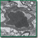 Transitory Increase of Hematoencephalic Barrier Permeability by Intracarotid Introduction of Ozonized Saline Solution