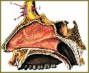 The Use of Hydrogel Materials Coletex-ADL and Colegel  in the Treatment of Purulent Frontal Sinusitis