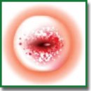 Inflammatory Proteins as Molecular Markers in the Diagnosis of Cervical Oncopathology