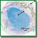 Reconstruction of the Rat Sciatic Nerve by Using Biodegradable and Non-Biodegradable Conduits