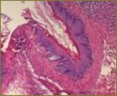 Ximedon Administration in Complex Treatment of Chemical Burns of Esophagus and Stomach in Experiment