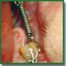 Effect of Low-Energy Nanosecond Laser Therapy on Reparative Osteogenesis <i>in vivo</i>