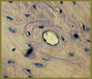 Biological Properties Study of a New Osteoplastic Nondemineralized Collagen-based Material Containing Vascular Endothelial Growth Factor in Bone Defect Replacement