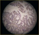 Clinical Relevance of Compression Elastography in Differential Diagnosis of Pancreatic Cystic Masses