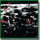 Improving the Transverse Resolution of Optical Coherence Tomography with a Finite Impulse Response Filter and a Series of Numerically Refocused Images