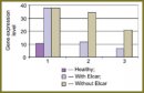 Gene Control of Programmed Myocardial Cell Death  in Acute Myocardial Infarction, Its Dynamics in Treatment  and Prospects for Therapy