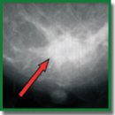 Current Methods for the Assessment of Oxygen Status and Biotissue Microcirculation Condition: Diffuse Optical Spectroscopy (Review)