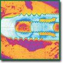 Plasma Electrolytic Oxidation for Dental Implant Surface Treatment