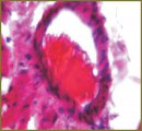 The Effect of Sterofundin and Cytoflavin on Morphological Changes in Myocardium in Acute Massive Blood Loss in Experiment