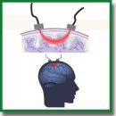 The Potential of Near-Infrared Spectroscopy as a Therapeutic Tool Following a Stroke (Review)