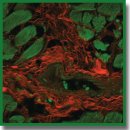 Трехмерная визуализация коллагеновых волокон миокарда человека с помощью окраски трипановым синим