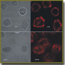 A Targeted Toxin Based on a Binding Module of Non-Immunoglobulin Scaffold as a New Agent for Theranostics