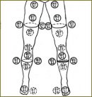 The Use of Radiothermometry in Determining the Level and the Way of Lower Limbs Amputation in Patients with Critical Ischemia