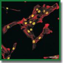 Proliferative Activity of Healthy and Degenerated Intervertebral  Disc Cells <i>in vitro</i> under Bone Morphogenetic Proteins’ Influence:  Implications for Cell Therapy