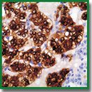 Morphological and Cytophysiological Changes in the Adult Rat Adrenal Medulla after Prenatal and Postnatal Exposure to Endocrine-Disrupting DDT