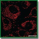 Цитопротекторное действие фумарата натрия в условиях <i>in vitro</i> модели гипоксии с применением дитионита натрия