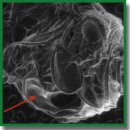 Valve Formation during Colostomy by Means of Spherical Implants Based on Titanium Nickelide Both Wrapping and Non-Wrapping the Serous-Muscular Layer of the Intestine