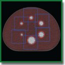 Evaluation of the Accuracy of Standardized Uptake Values of <sup>18</sup>F-Fluorodeoxyglucose in Lung Lesions Based on Phantom Studies
