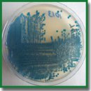 Current Molecular Genetic Technologies to Study Hospital Strains