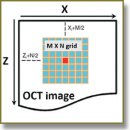 Evaluation of Freshness of Soft Tissue Samples with Optical Coherence Tomography Assisted by Low Frequency Electric Field
