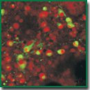 Application of the AAV-Syn-BDNF-EGFP Virus Vector as a Neuroprotective Agent in Modeling Hypoxia <i>in vitro</i>